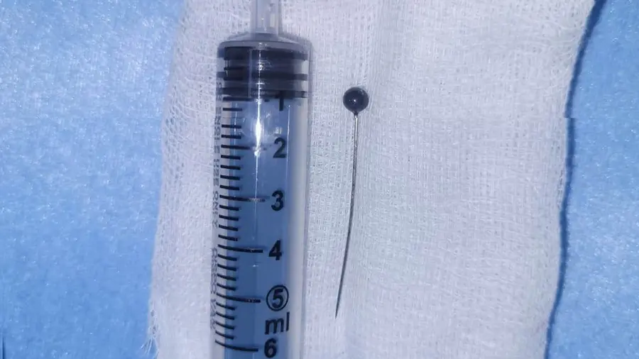 needle stuck in her throat