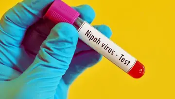 nipah test
