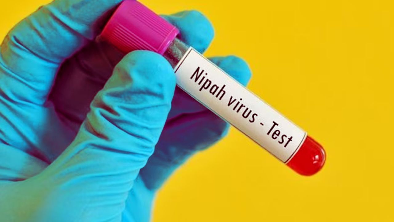 nipah test