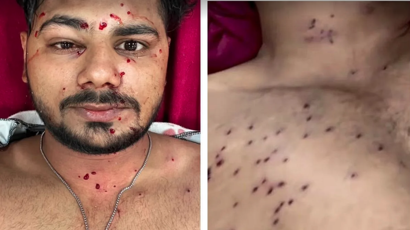 pellet wounds 2