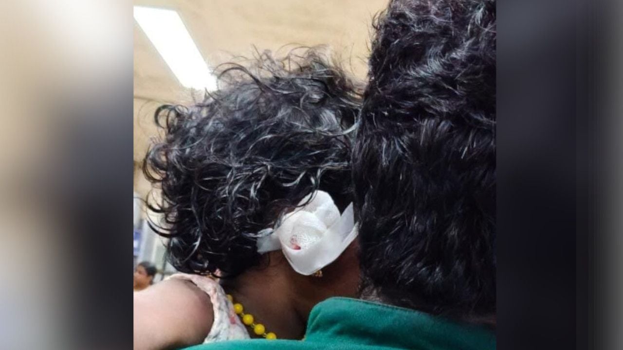 paravur stray dog attack