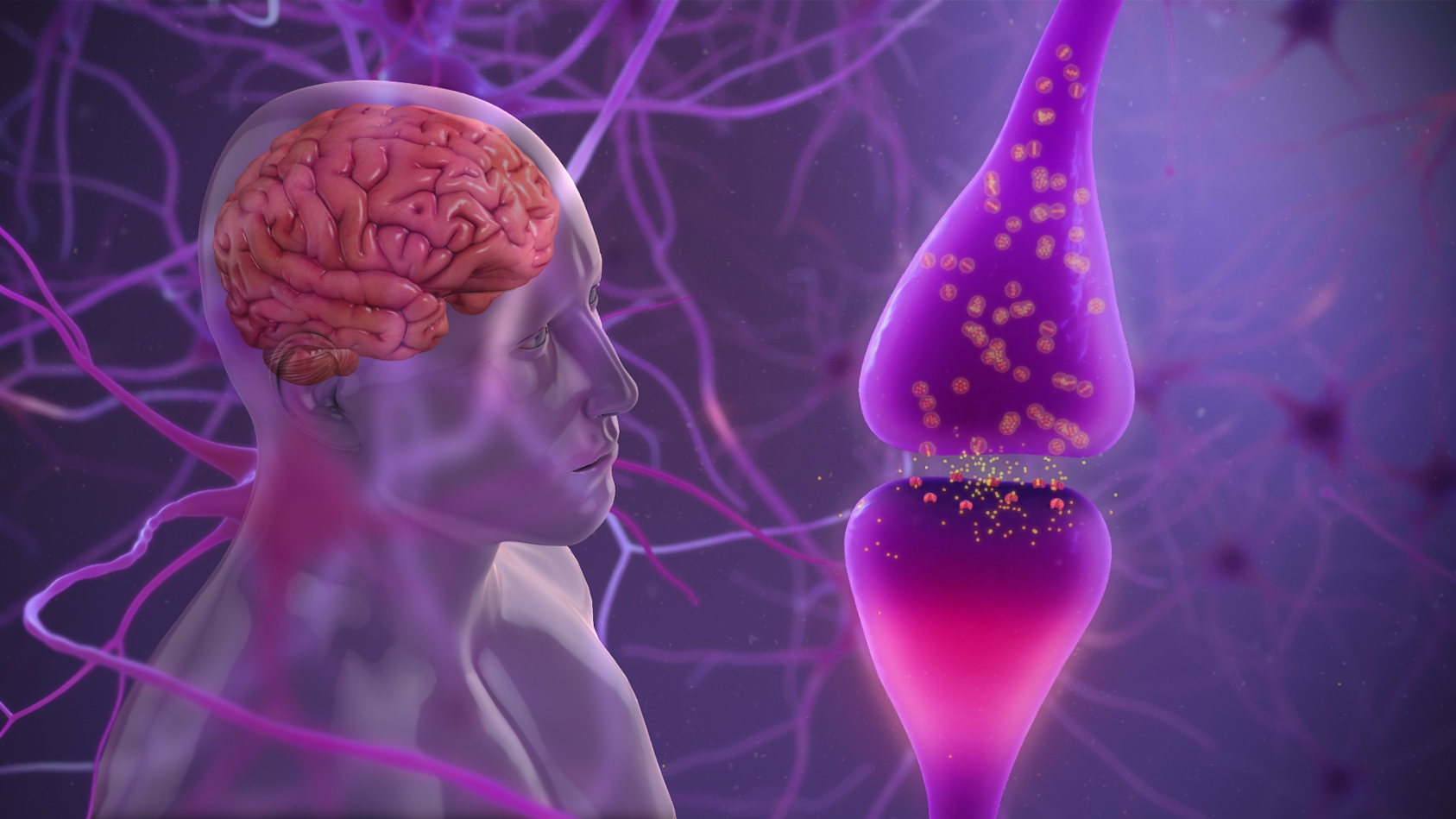 parkinsons