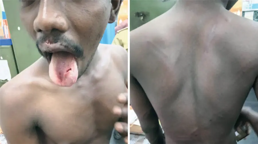 rss attack against dalit family