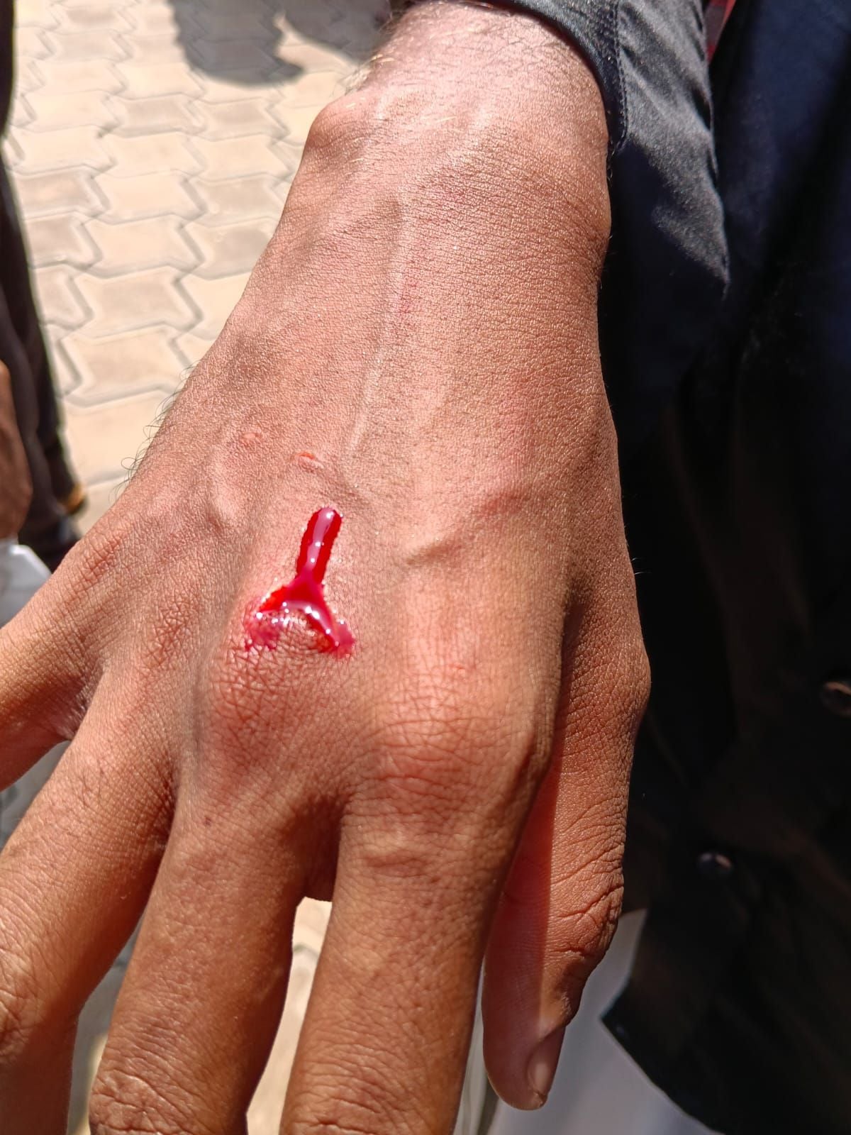 sfi protest