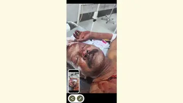 പരിക്കേറ്റ ഷൈജു