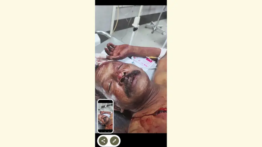 പരിക്കേറ്റ ഷൈജു