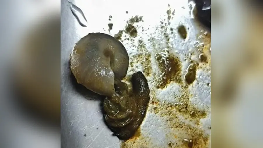 snail in egg curry