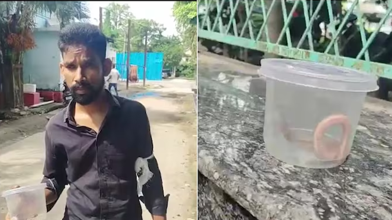 Snake Bite 