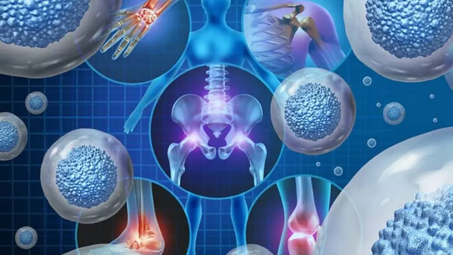 Stem cell therapy