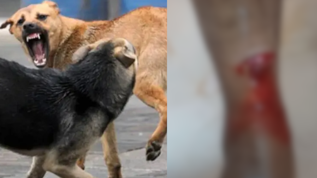 ramapuram  street dog bite