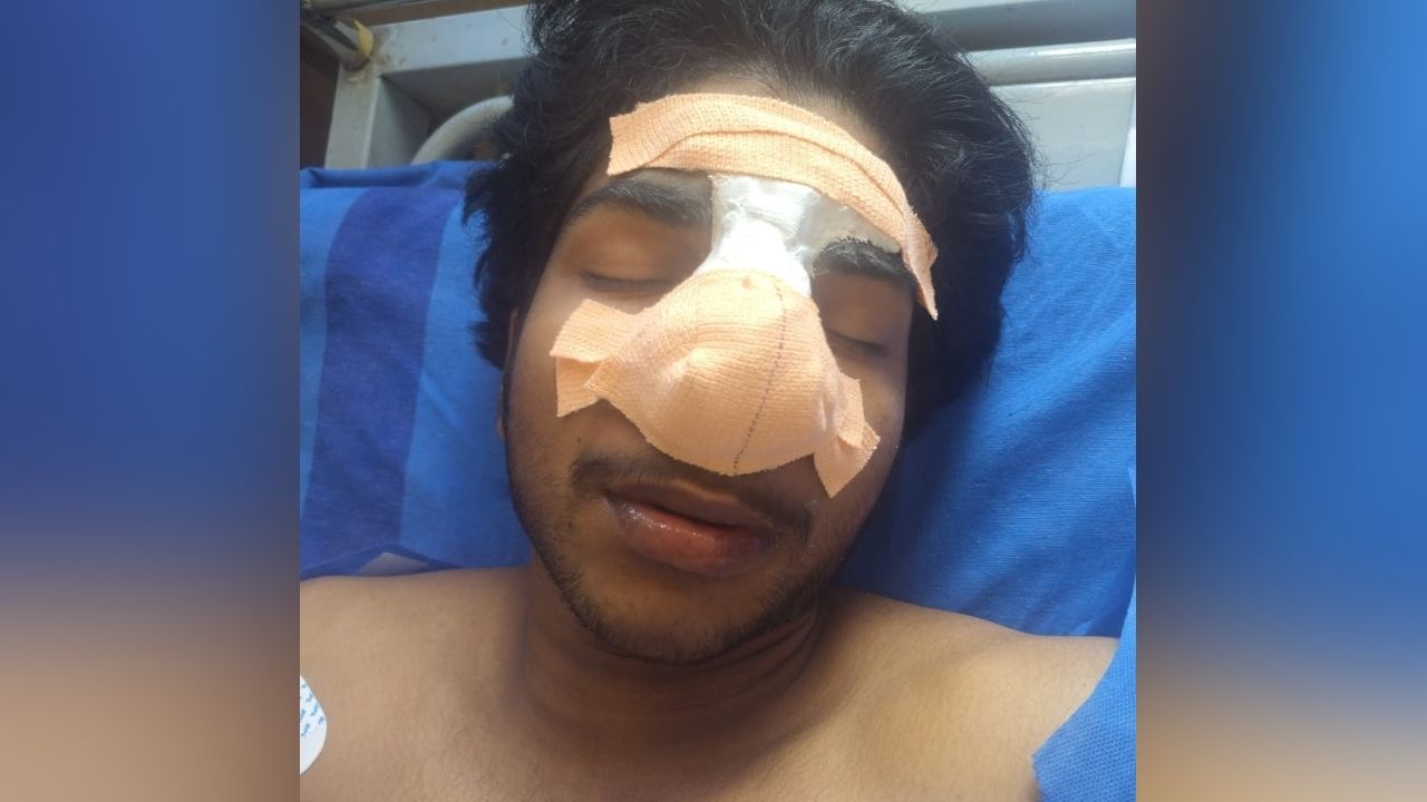 student injured