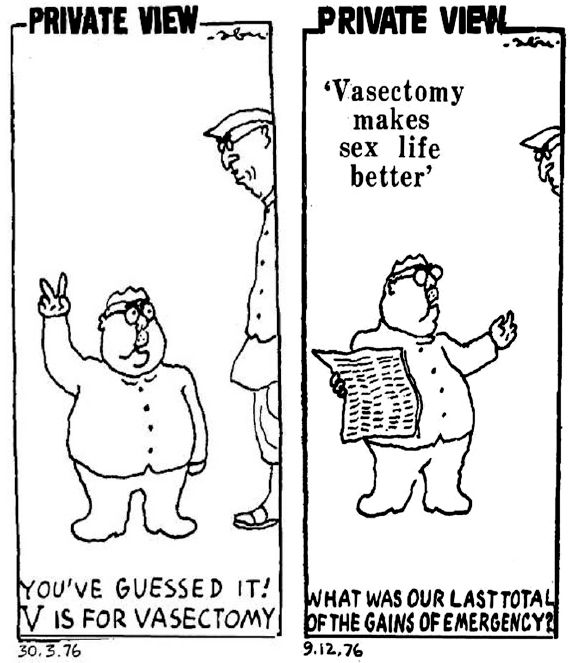 vasectomy