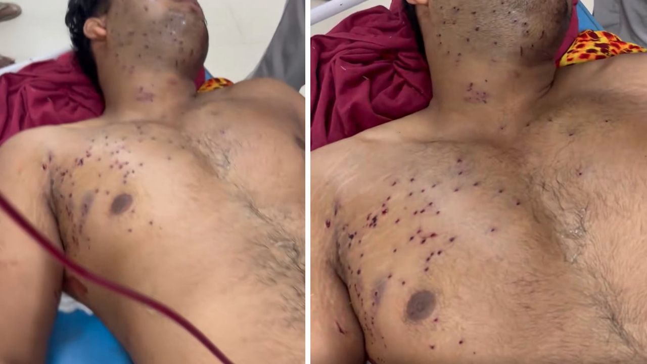youth injured with pellet gun